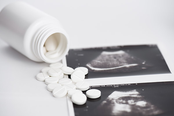 abortion pill inline